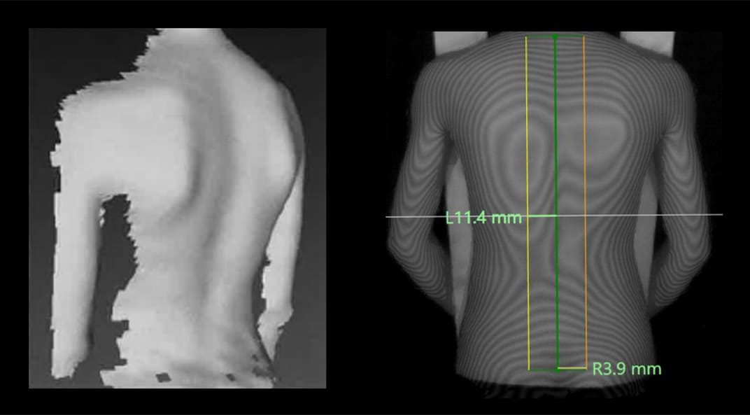 Body Surface Data Captured by Senaka Scan