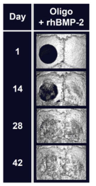 Bone Regeneration with gel(Our gel accelerated bone regeneration)