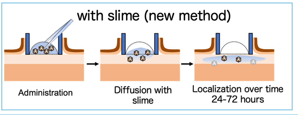 Controlled Drug Delivery